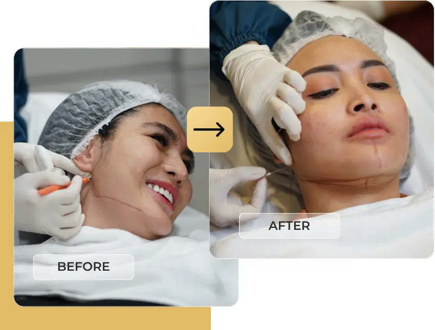 Kelebihan Double Needle Thread di SkinEvo