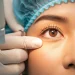 Apa Itu Operasi LASIK